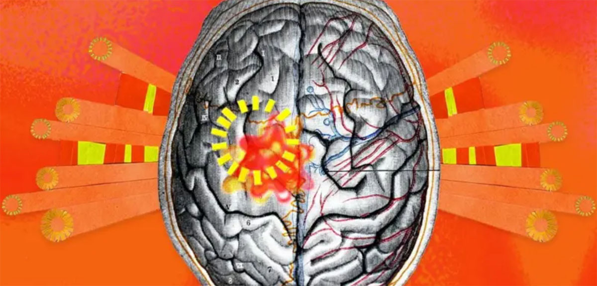 विश्व झन्‌झन् तातो बन्दै जाँदा मानिसको मस्तिष्कमा पनि त्यसको प्रभाव